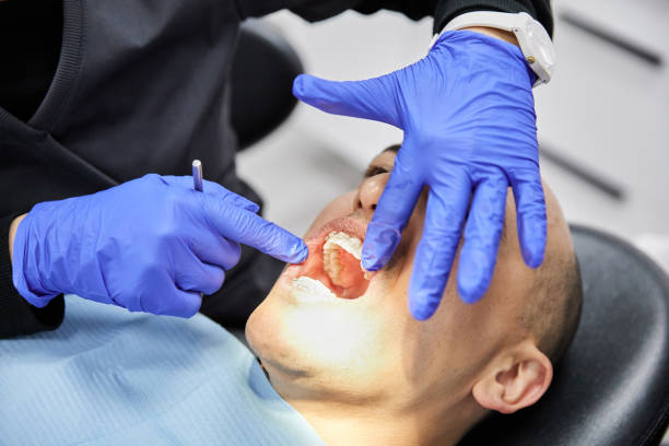 Best Emergency Dental Care for Broken or Chipped Teeth in La Plata, NM